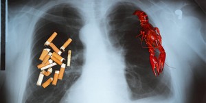 Рак легені : клінічна картина