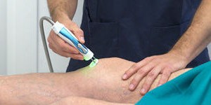 Як лікувати гонартроз колінного суглоба