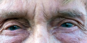 Лікування старечої сліпоти