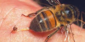 Що робити, якщо вкусила бджола?