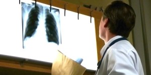 Боротьба з туберкульозом