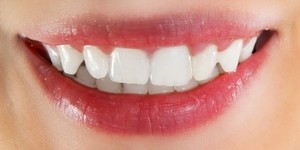 Народні засоби для відбілювання зубів